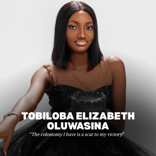 Survivor Spotlight Tobiloba Oluwasina