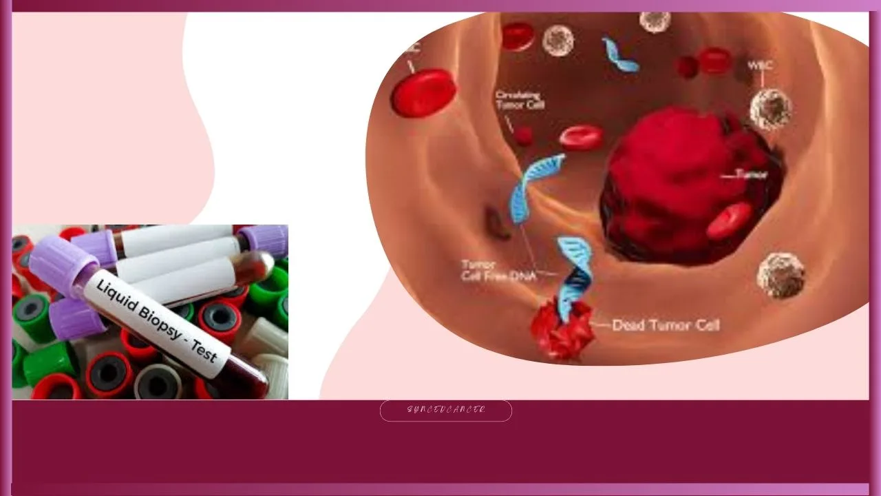 Liquid Biopsies