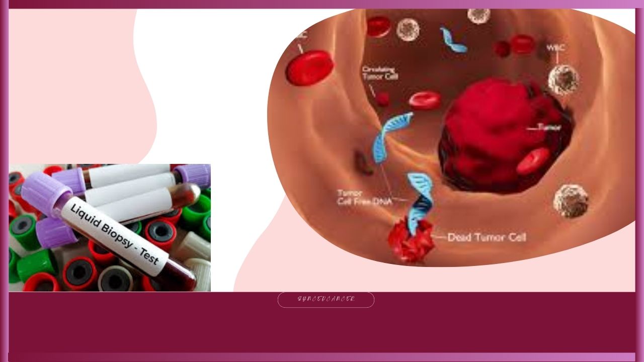 Liquid Biopsies