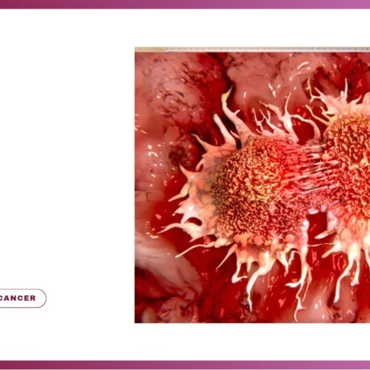Tumor
