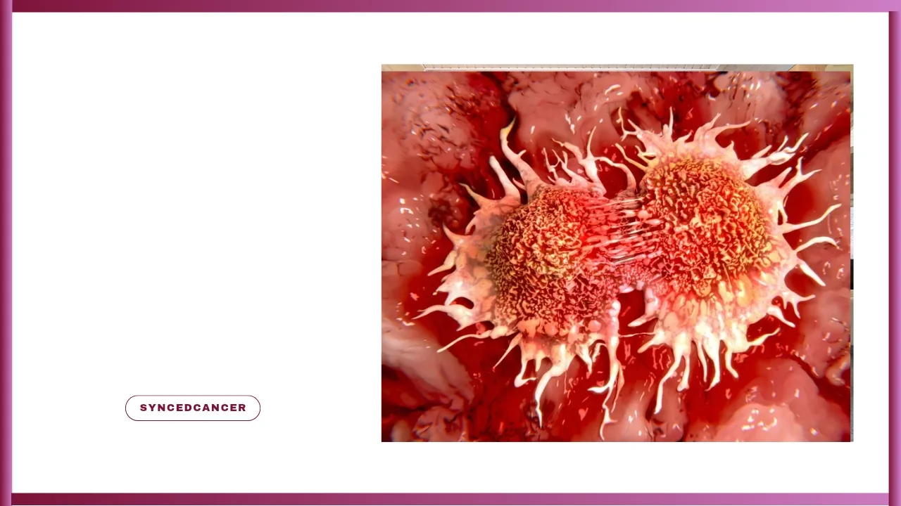Tumor