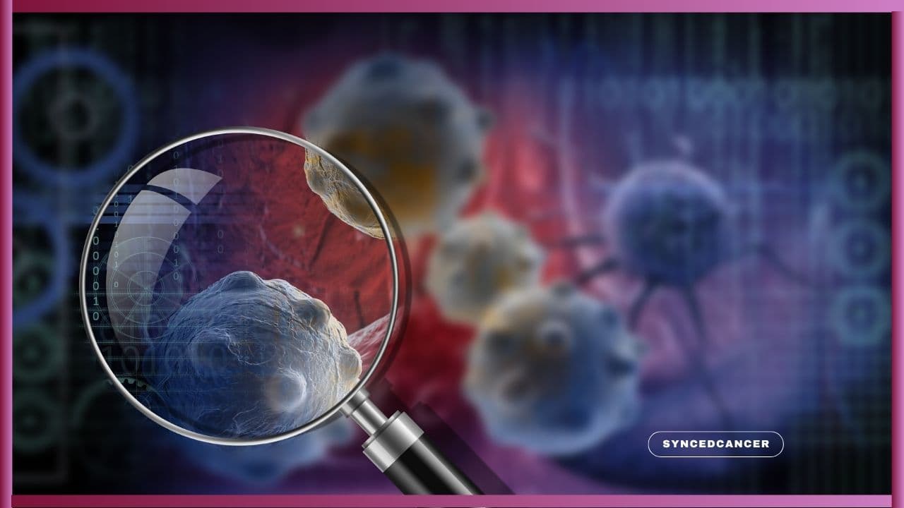 New Primary Cancer